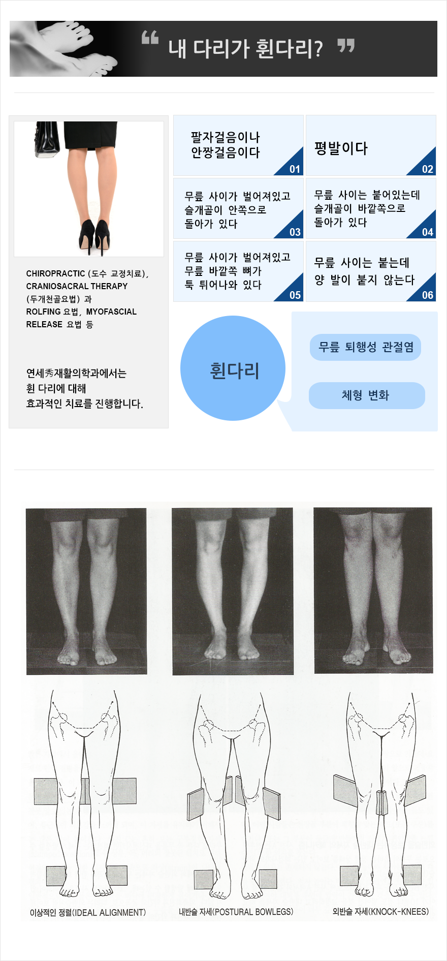 휜다리