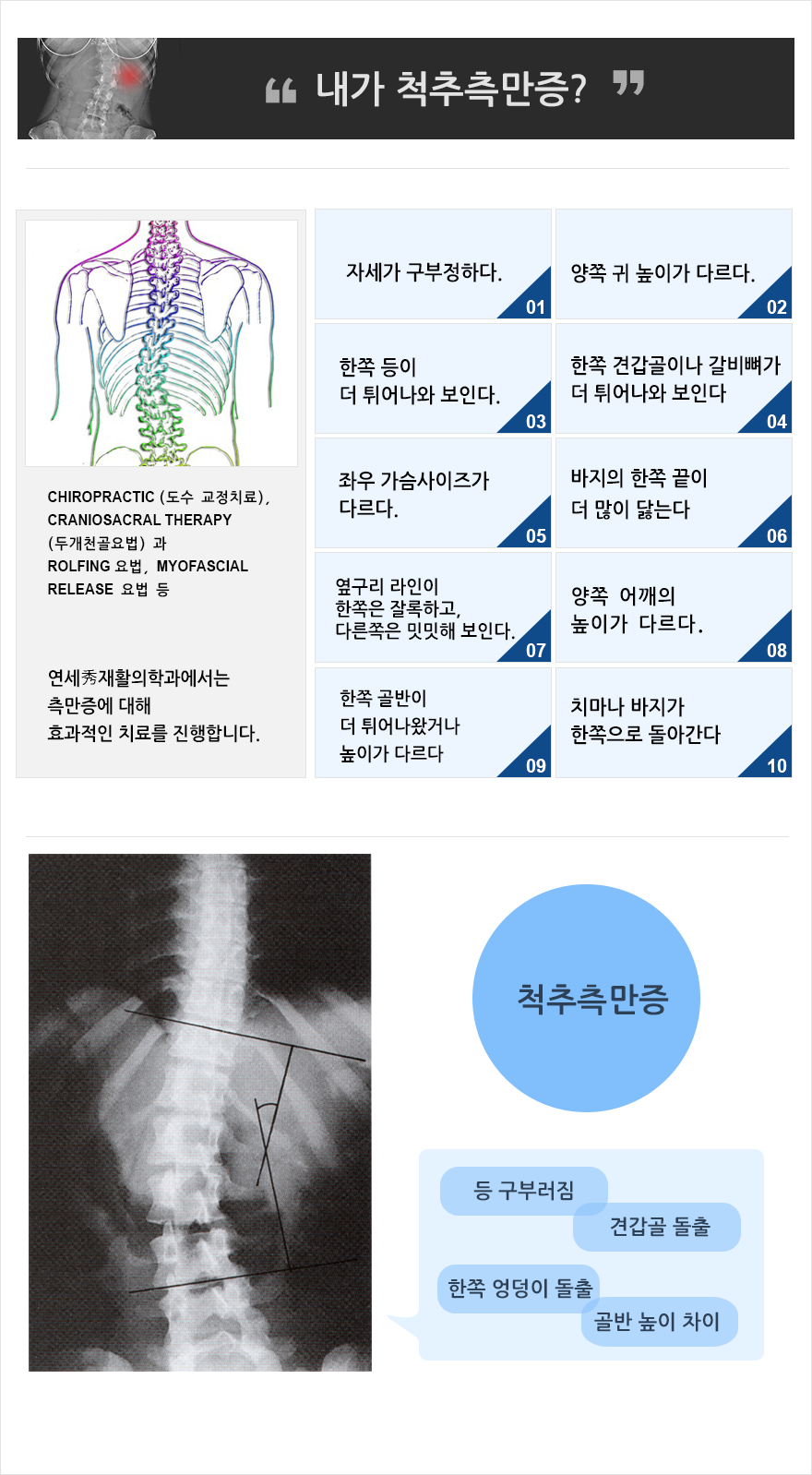 측만증